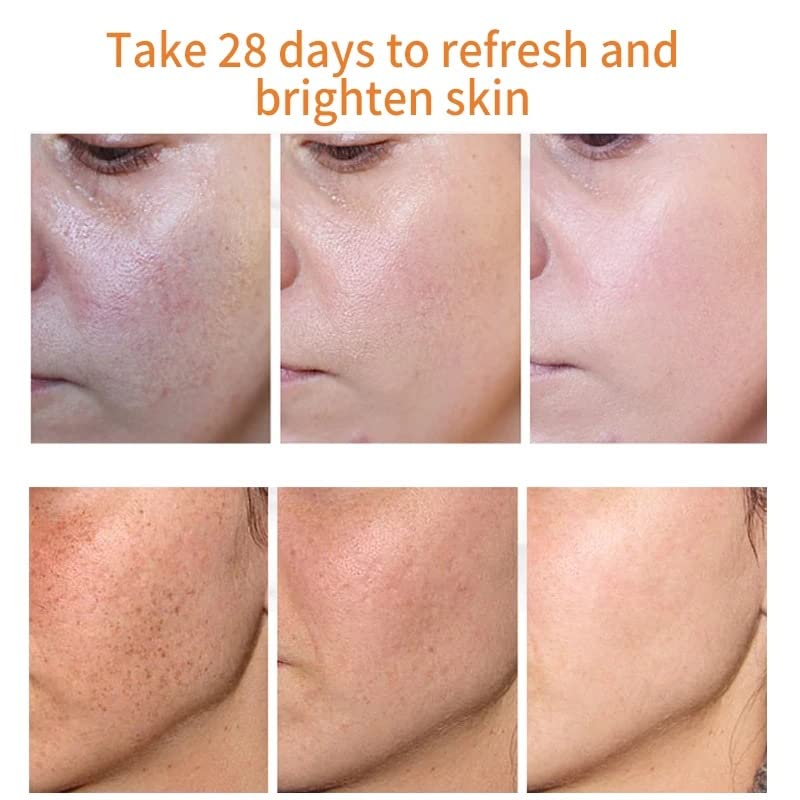 MILIZHIWU Melanina Anti-Melasma Capsule, Skin Brightening Supplement for Hyperpigmentation, Podocarpus Odoratus Extract, Vitamin C & Natural Extracts, Supports Even Skin Tone & Radiance 60 Capsules
