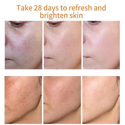 MILIZHIWU Melanina Anti-Melasma Capsule, Skin Brightening Supplement for Hyperpigmentation, Podocarpus Odoratus Extract, Vitamin C & Natural Extracts, Supports Even Skin Tone & Radiance 60 Capsules
