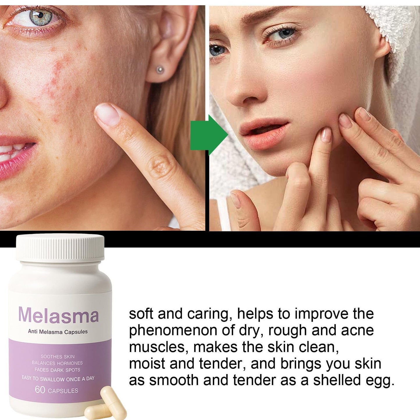 MILIZHIWU Melanina Anti-Melasma Capsule, Skin Brightening Supplement for Hyperpigmentation, Podocarpus Odoratus Extract, Vitamin C & Natural Extracts, Supports Even Skin Tone & Radiance 60 Capsules