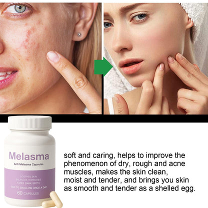 MILIZHIWU Melanina Anti-Melasma Capsule, Skin Brightening Supplement for Hyperpigmentation, Podocarpus Odoratus Extract, Vitamin C & Natural Extracts, Supports Even Skin Tone & Radiance 60 Capsules