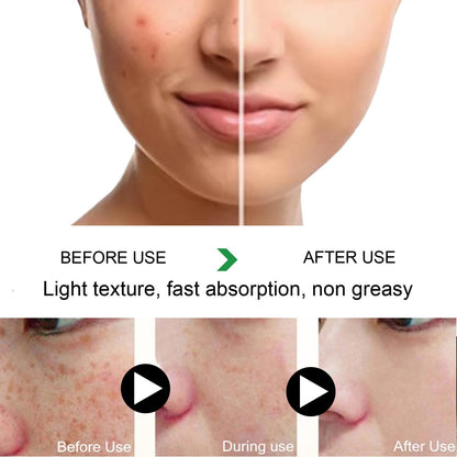 MILIZHIWU Melanina Anti-Melasma Capsule, Skin Brightening Supplement for Hyperpigmentation, Podocarpus Odoratus Extract, Vitamin C & Natural Extracts, Supports Even Skin Tone & Radiance 60 Capsules