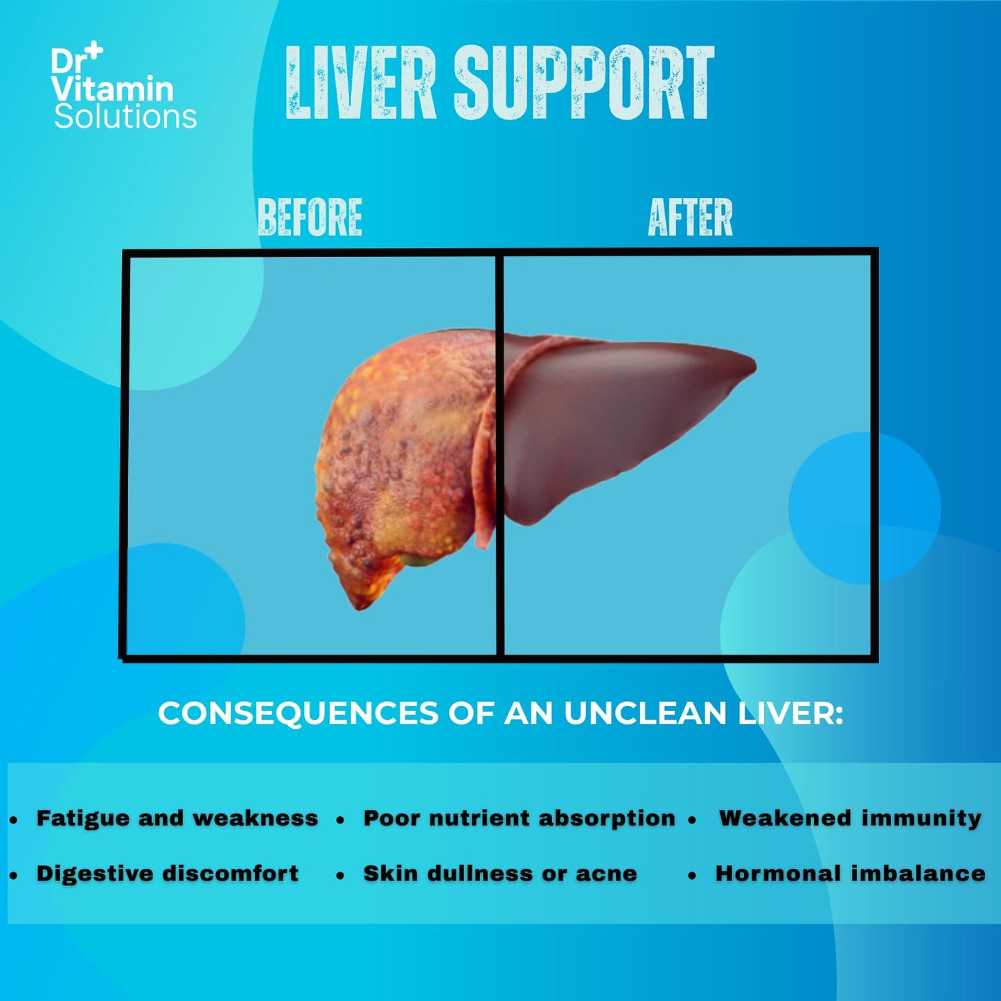 DR Vitamin Solutions Liver Cleanse Detox — Milk Thistle & Enzymes
