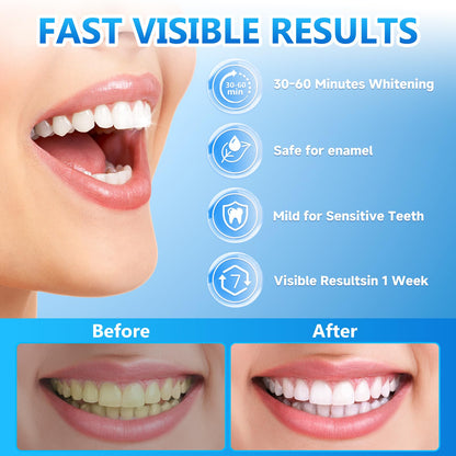 Milumber Teeth Whitening Strips for Sensitive – 42 Strips, Enamel Safe, Mint