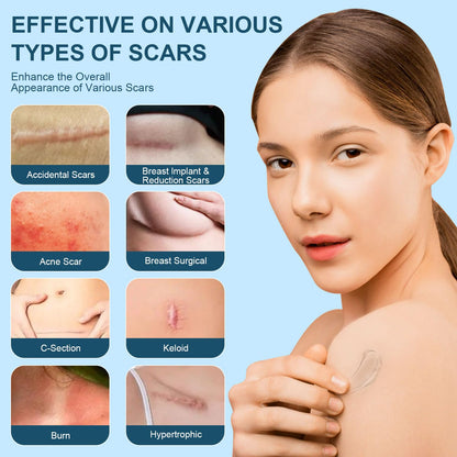 Mitgary Advanced Scar Gel – Silicone Scar Treatment for New & Old Scars | 50 g