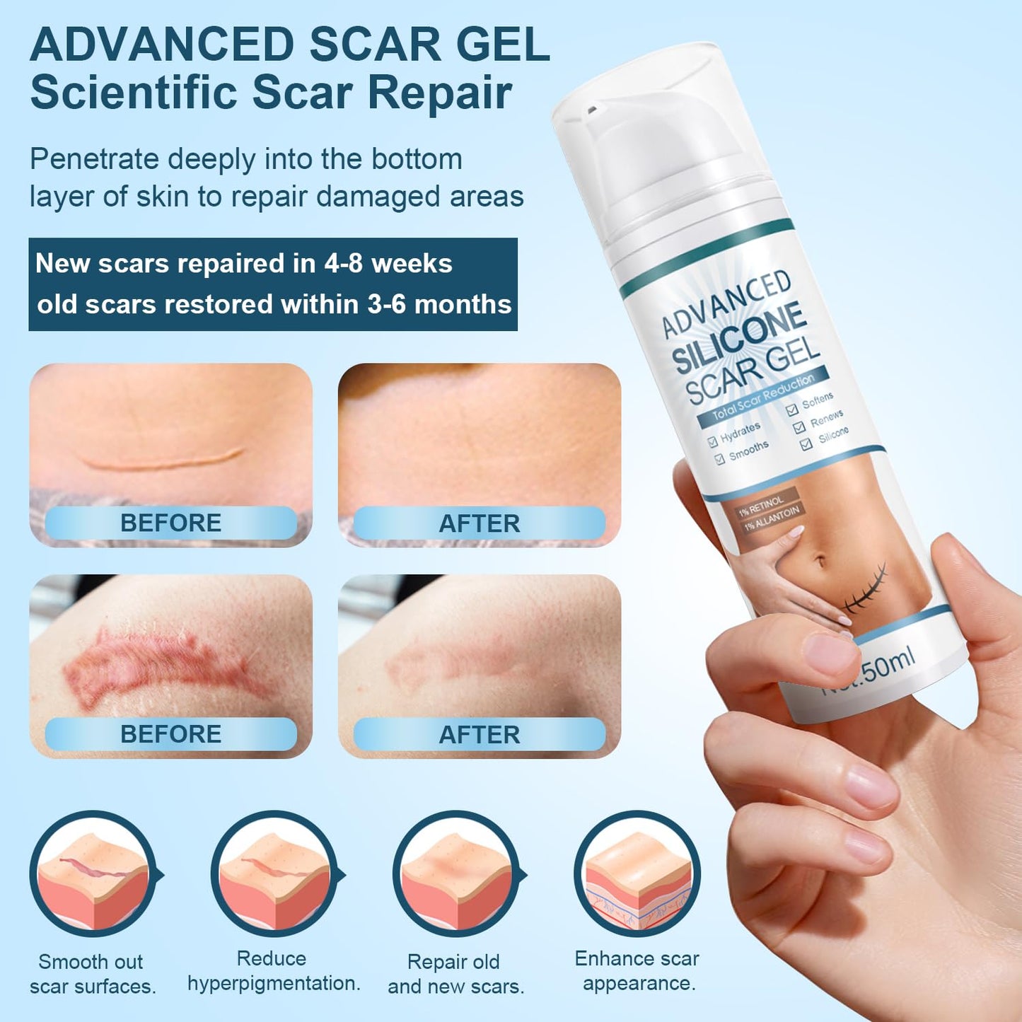 Mitgary Advanced Scar Gel – Silicone Scar Treatment for New & Old Scars | 50 g