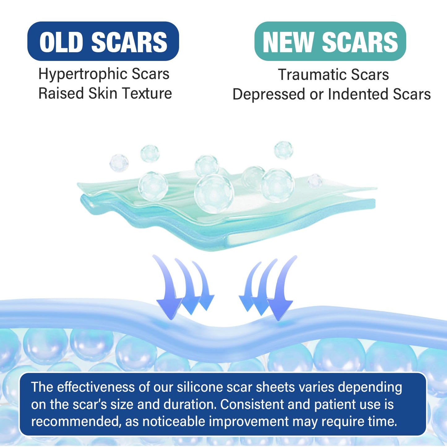 Mitreal Silicone Scar Sheets & Tape — 1.6x158 Roll for Surgical Scars & Keloids