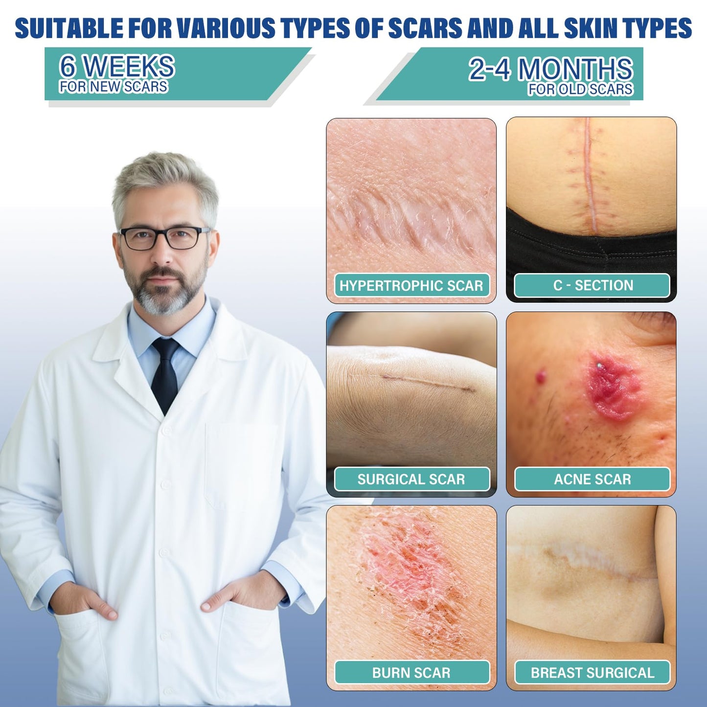 Mitreal Silicone Scar Sheets & Tape — 1.6x158 Roll for Surgical Scars & Keloids