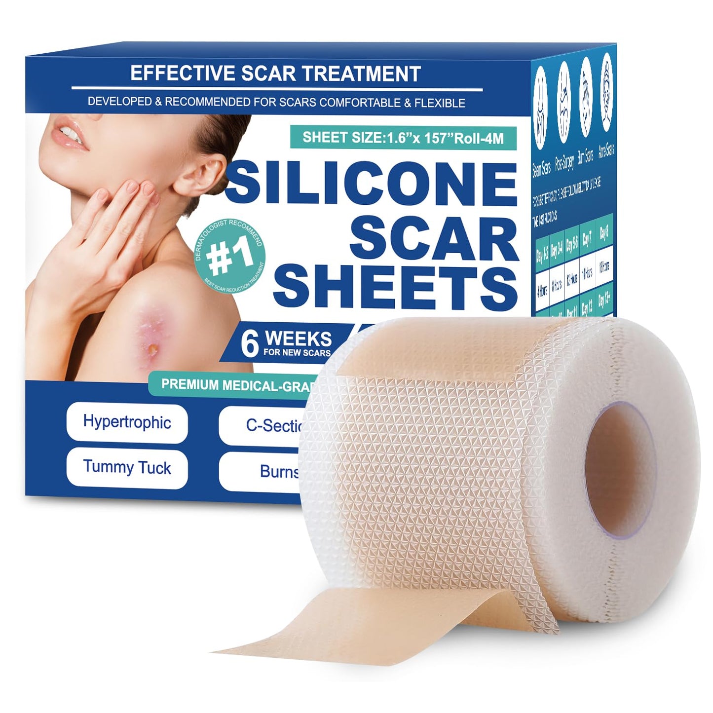 Mitreal Silicone Scar Sheets & Tape — 1.6x158 Roll for Surgical Scars & Keloids