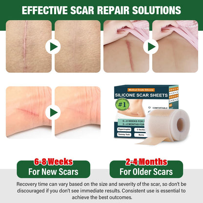 Mitreal Silicone Scar Sheets – 1.6x60 in Roll for Surgical Scars & Keloids