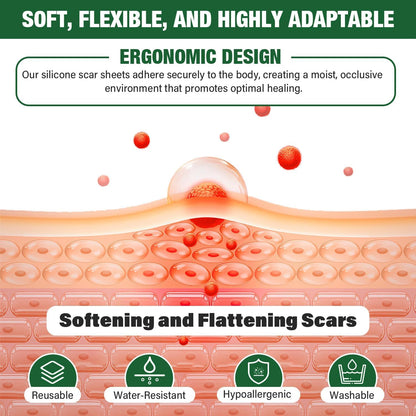 Mitreal Silicone Scar Sheets – 1.6x60 in Roll for Surgical Scars & Keloids