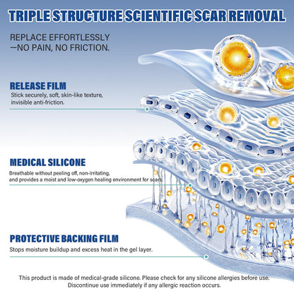 Mitreal Silicone Scar Sheets & Tape — 1.6x158 Roll for Surgical Scars & Keloids