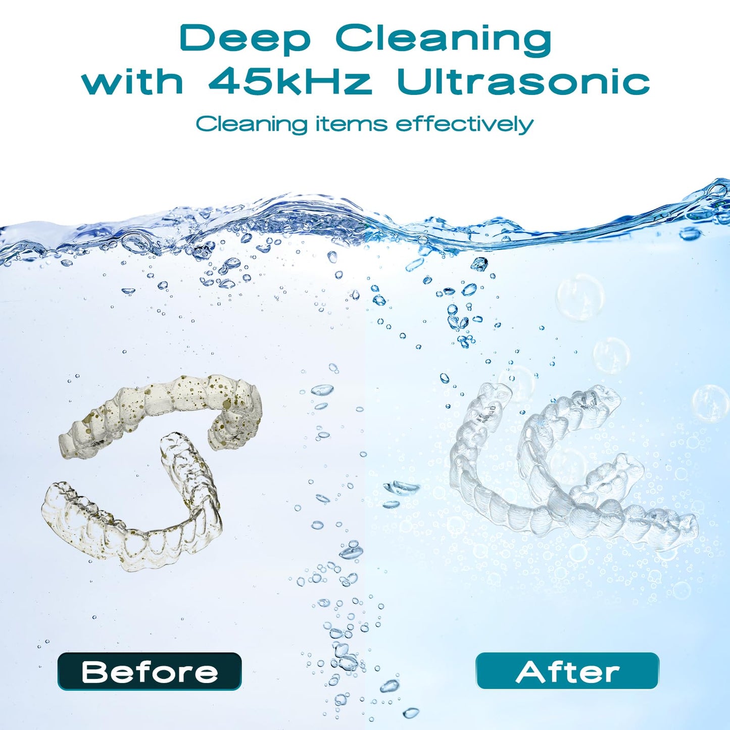 MNTNCO Ultrasonic Retainer Cleaner - White Cleaning Machine for Dentures