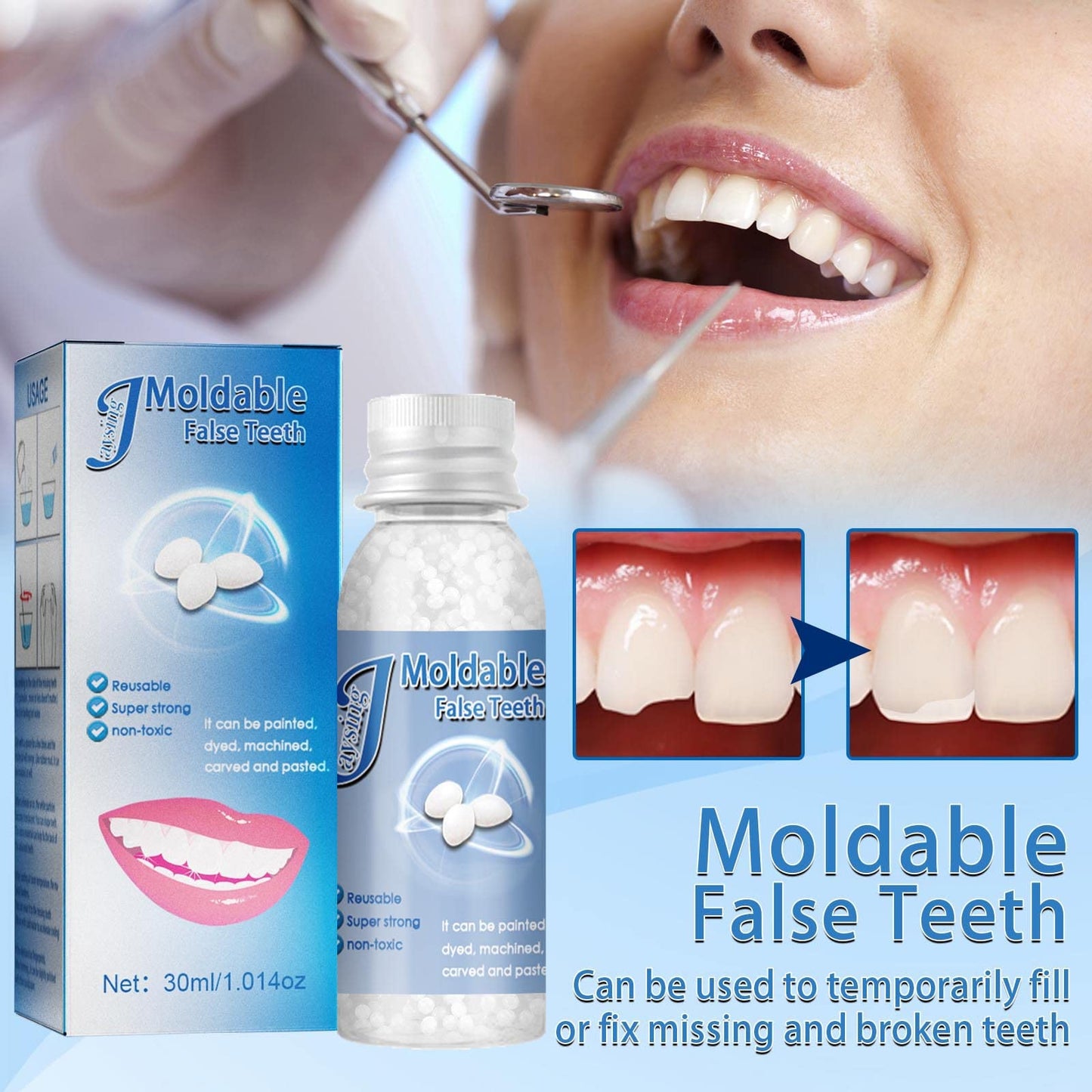 Denture Repair Kit: Moldable Beads, Tweezers & Dental Tools for Fixing Missing or Broken Teeth