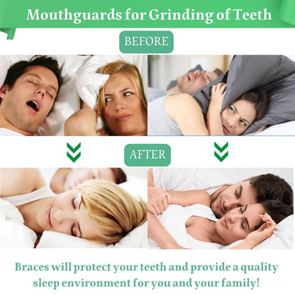 Mouth Guard for Clenching Teeth at Night – 4 Pack Night Guards