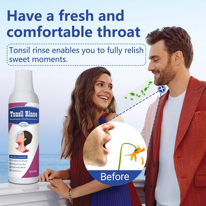 Tonsil Stone Remover with Alcohol-Free Oral Rinse – 300ml (10.14 fl oz) | Fresh Breath