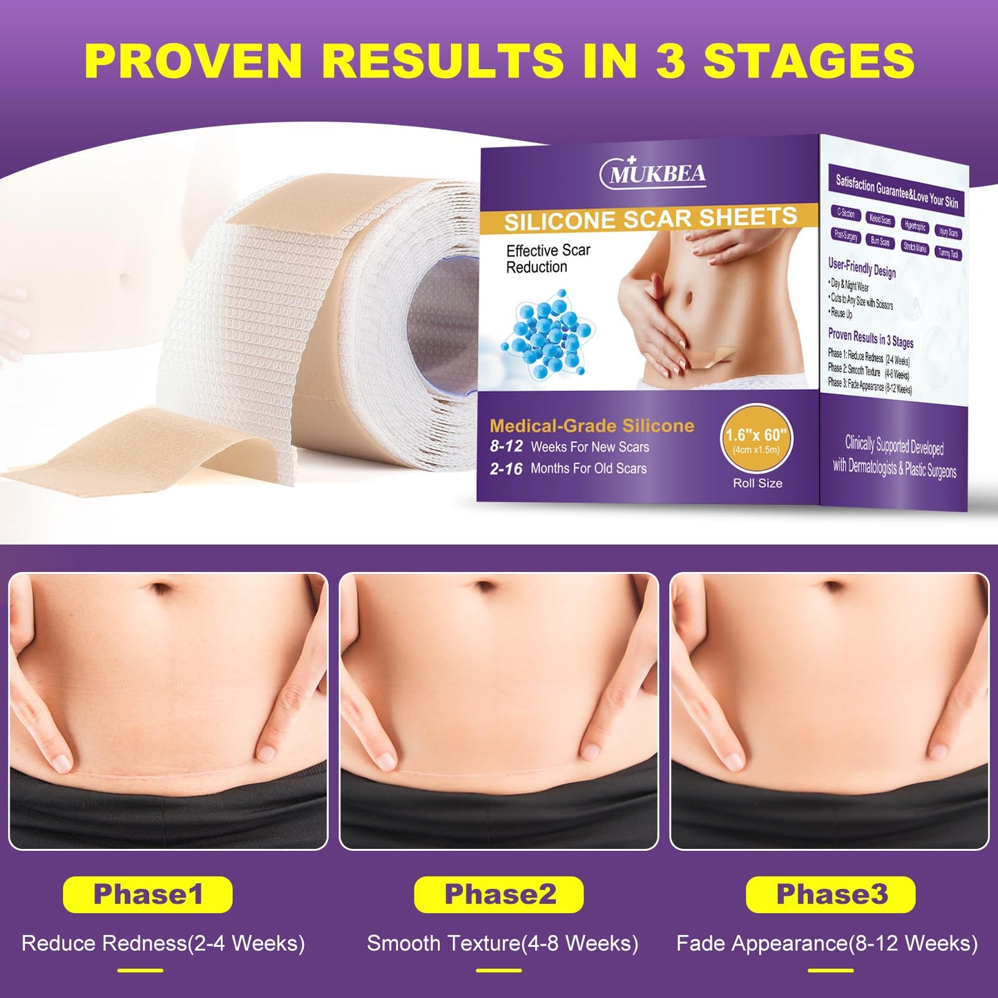 MUKBEA Silicone Scar Sheets & Tape – Reusable Scar Tape for Keloids, Surgical Scars, C-Section, Acne Scars (1.6” x 60” Roll, 1.5m)