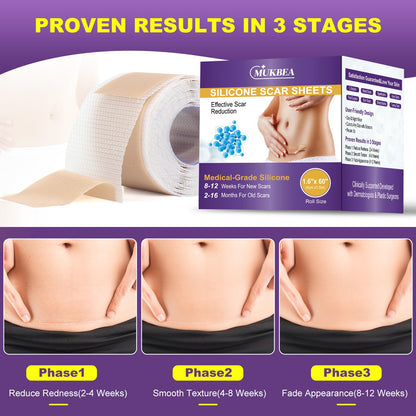 MUKBEA Silicone Scar Sheets & Tape – Reusable Scar Tape for Keloids, Surgical Scars, C-Section, Acne Scars (1.6” x 60” Roll, 1.5m)