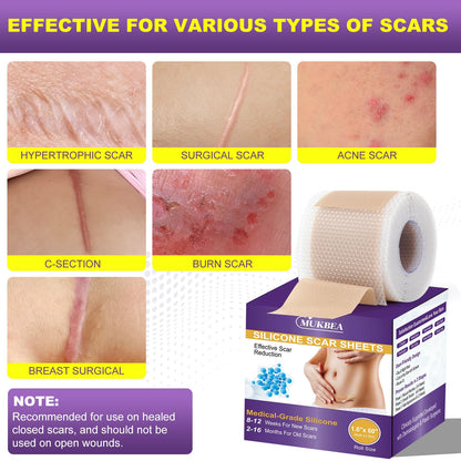 MUKBEA Silicone Scar Sheets & Tape – Reusable Scar Tape for Keloids, Surgical Scars, C-Section, Acne Scars (1.6” x 60” Roll, 1.5m)