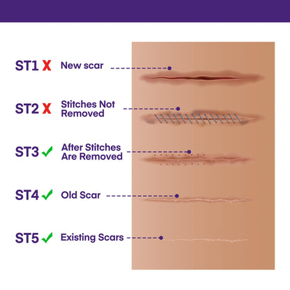 MURASAKI BEAUTY Silicone Scar Gel SPF 30 – Medical-Grade Scar Cream (1.06oz)
