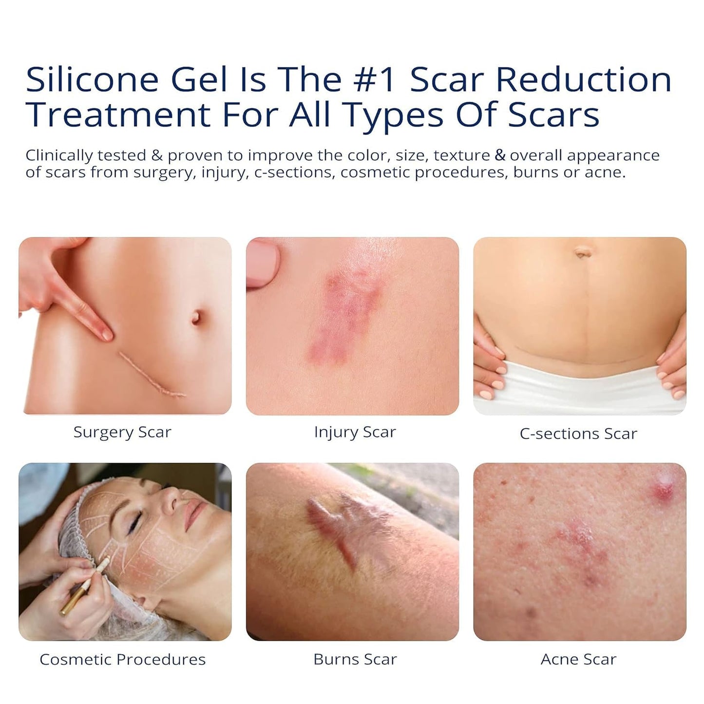 MURASAKI BEAUTY 100% Silicone Scar Gel – Maximum-Strength Scar Cream
