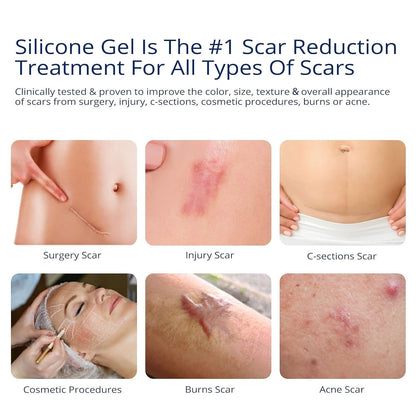 MURASAKI BEAUTY 100% Silicone Scar Gel – Maximum-Strength Scar Cream