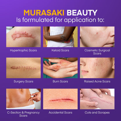MURASAKI BEAUTY Silicone Scar Gel SPF 30 – Medical-Grade Scar Cream (1.06oz)