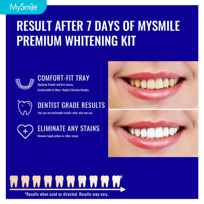 MySmile 7-Day Prefilled Teeth Whitening Trays Kit – 12% Hydrogen Peroxide, Mint