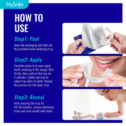 MySmile 7-Day Prefilled Teeth Whitening Trays Kit – 12% Hydrogen Peroxide, Mint