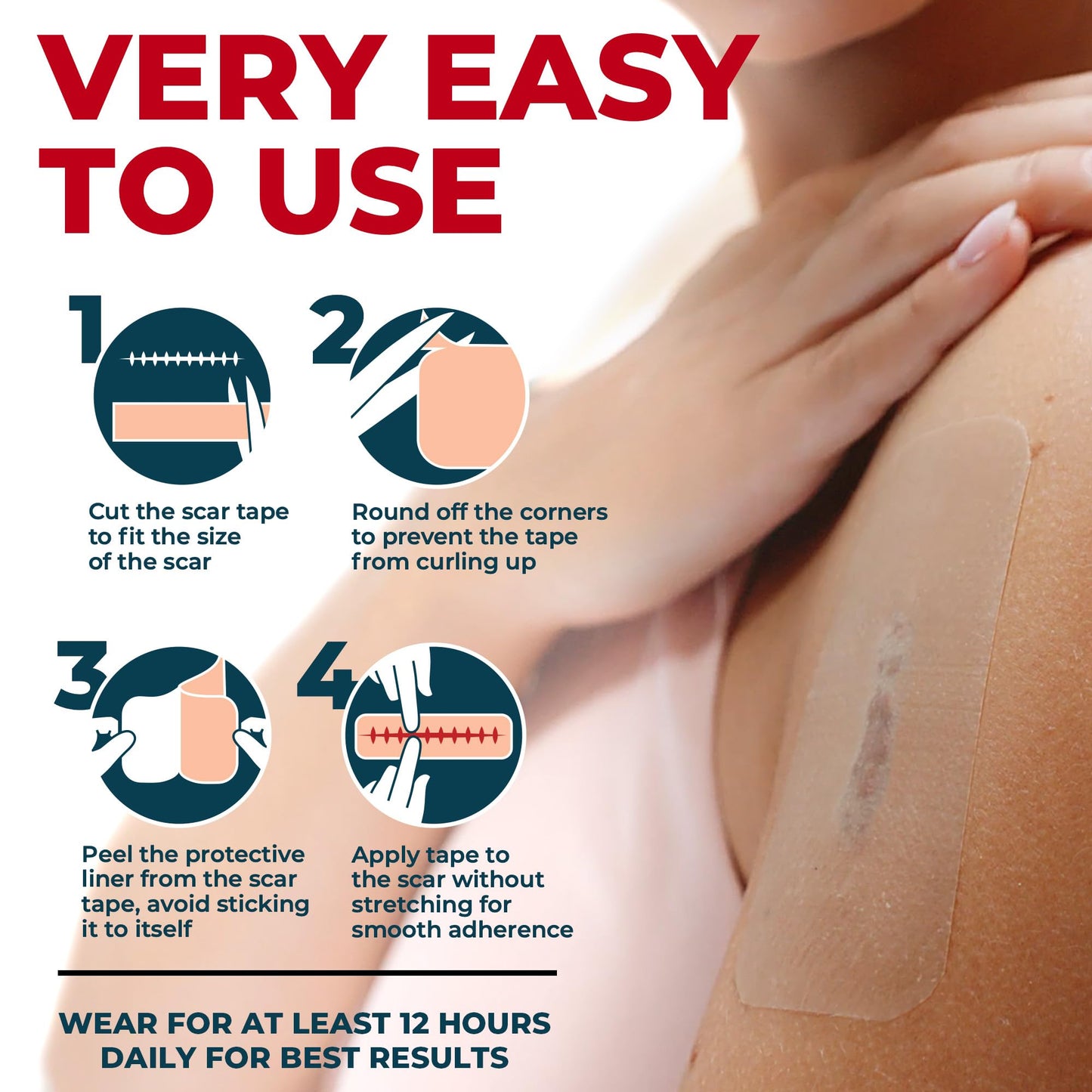 MYHELP Medical Grade Silicone Scar Tape - Transparent 1.6in x 120in for Surgical & Keloid Scars