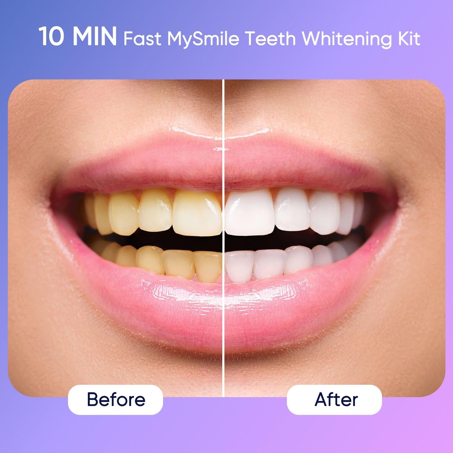 MySmile Deluxe 10 Min Teeth Whitening Kit – 28 LED, 35% Carbamide Peroxide