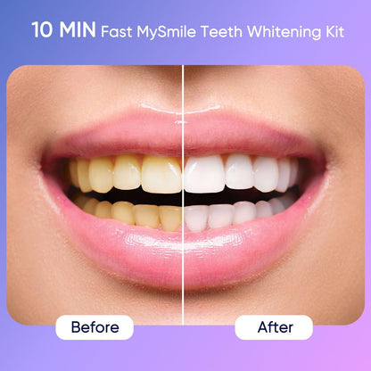 MySmile Deluxe 10 Min Teeth Whitening Kit – 28 LED, 35% Carbamide Peroxide