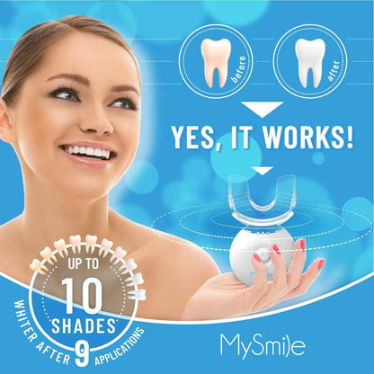 MySmile LED Teeth Whitening Kit - Fast 10-Min Non-Sensitive Whitener