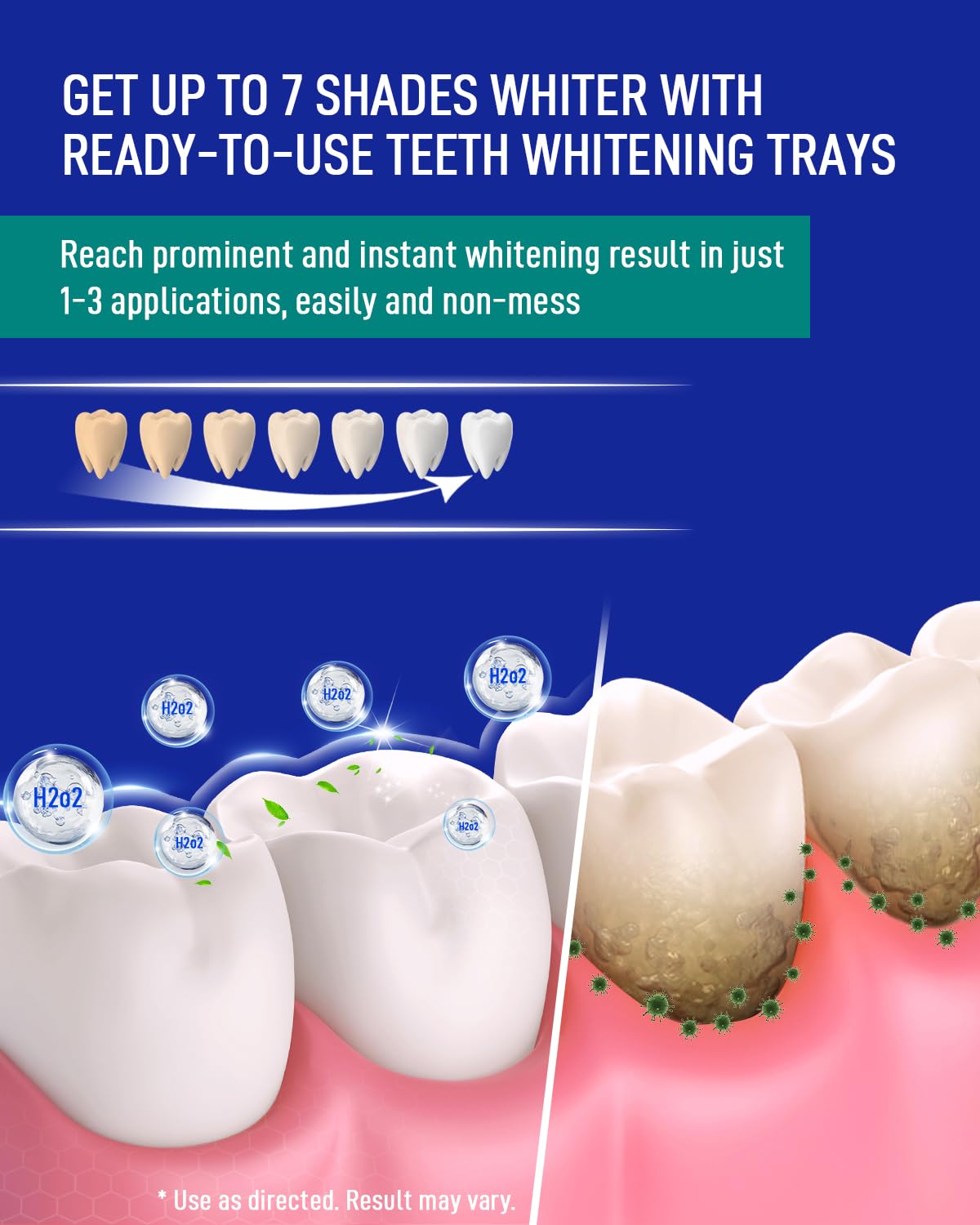 MySmile 7-Day Teeth Whitening Bundle - 12% Hydrogen Peroxide Trays + Fluoride-Free Nano Hydroxyapatite Toothpaste