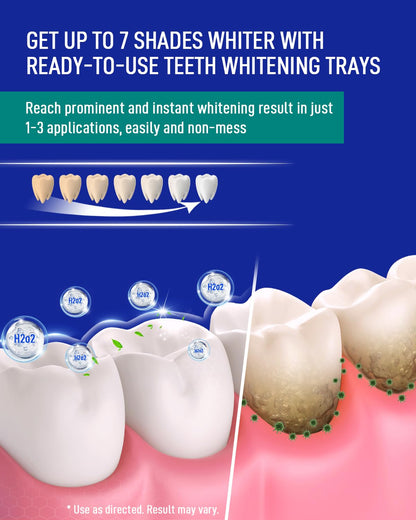 MySmile 7-Day Teeth Whitening Bundle - 12% Hydrogen Peroxide Trays + Fluoride-Free Nano Hydroxyapatite Toothpaste