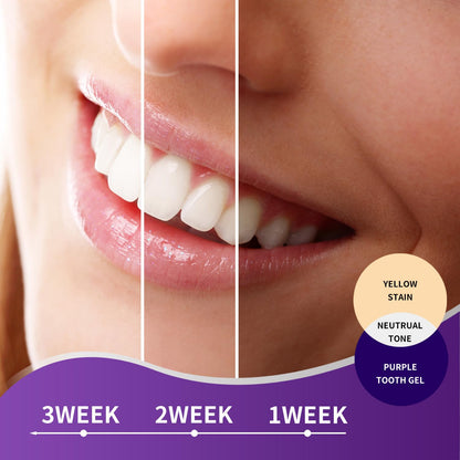 MySmile Purple Toothpaste - Color Correction & Brightening (30ML) | Non-Sensitive, Fresh Mint
