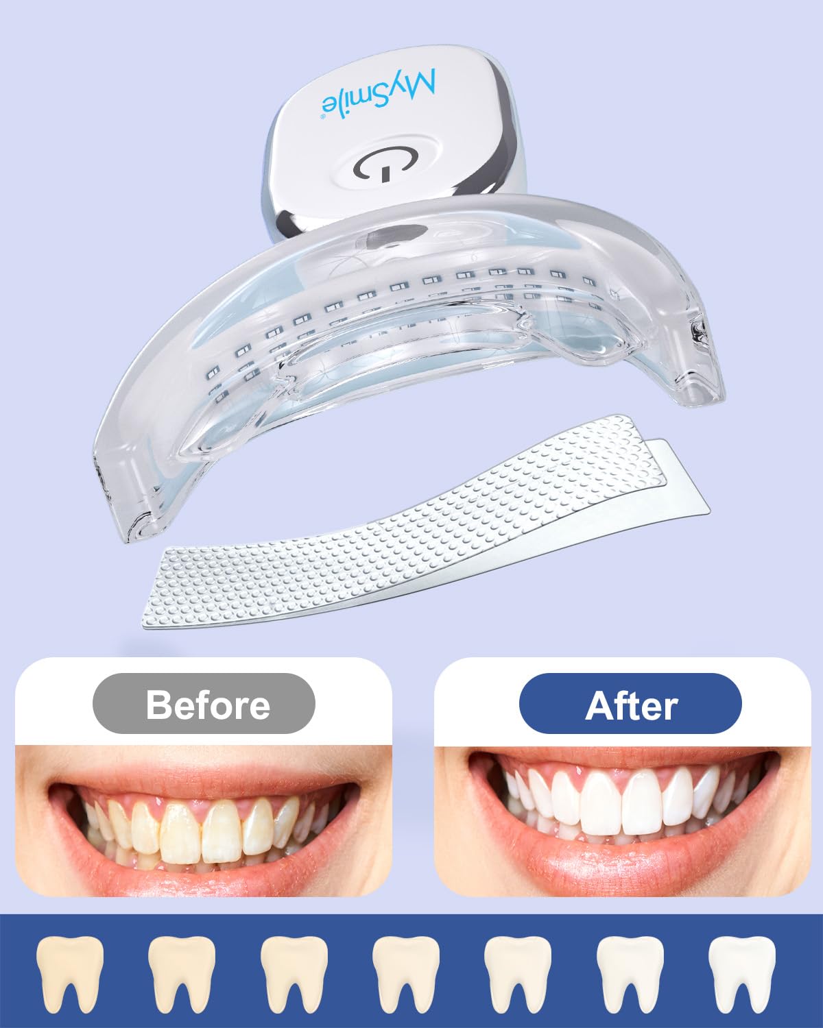 MySmile Teeth Whitening Strips Kit – 14 Treatments, 28 LED, Fast Whitening