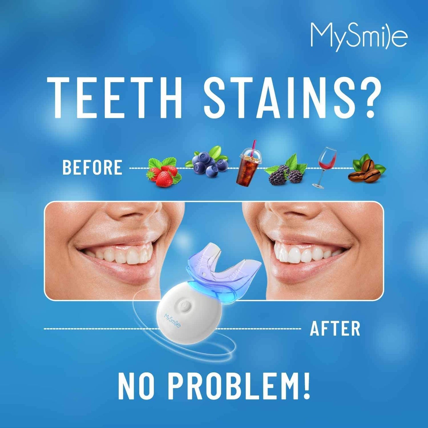 MySmile LED Teeth Whitening Kit - Fast 10-Min Non-Sensitive Whitener