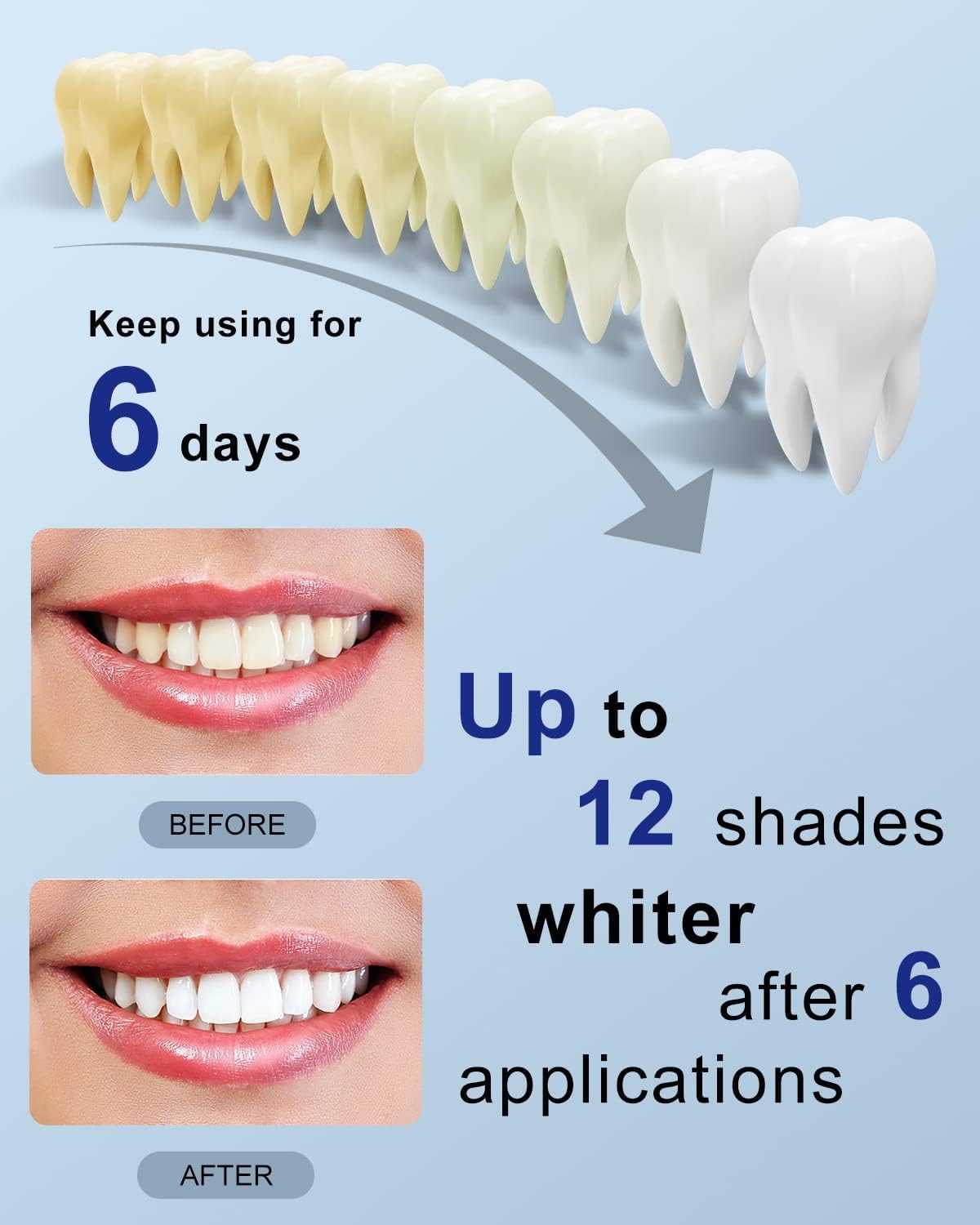 MySmile Teeth Whitening Strips Kit – 14 Treatments, 28 LED, Fast Whitening