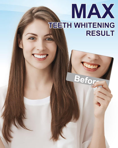MySmile Teeth Whitening Pen 30+ Treatments – Enamel Safe, Mint Flavor, 10-Minute Whitening