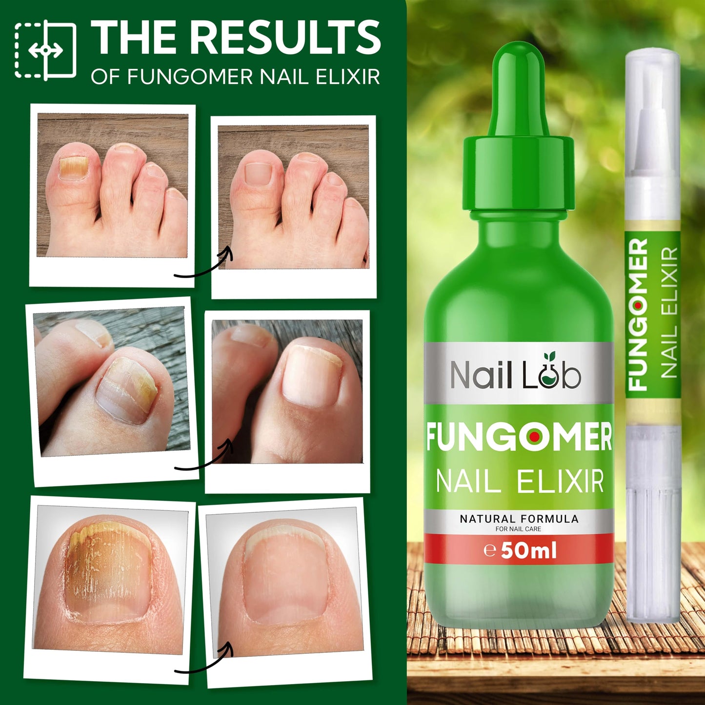 Toenail Fungus Treatment Extra Strength Pen – Nail Lab | 1-3 Week Visible Change