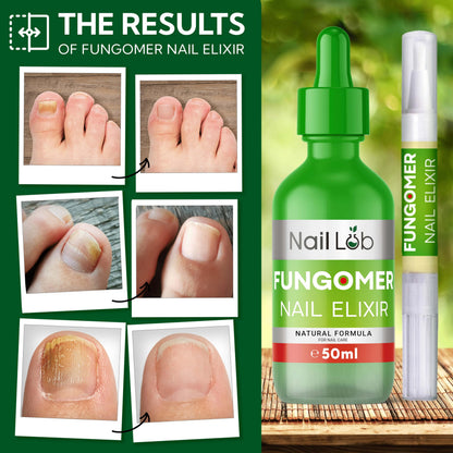 Toenail Fungus Treatment Extra Strength Pen – Nail Lab | 1-3 Week Visible Change