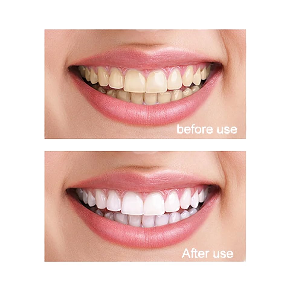 99.5% Pure Nano Hydroxyapatite Powder – DIY Toothpaste, Teeth Whitening & Soap (30g)