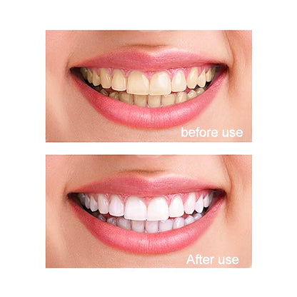 99.5% Pure Nano Hydroxyapatite Powder – DIY Toothpaste, Teeth Whitening & Soap (30g)