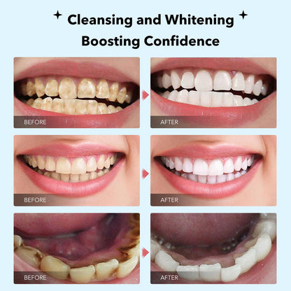 Fluoride-Free Nano Hydroxyapatite Toothpaste – Whitening & Remineralizing (4.23oz)