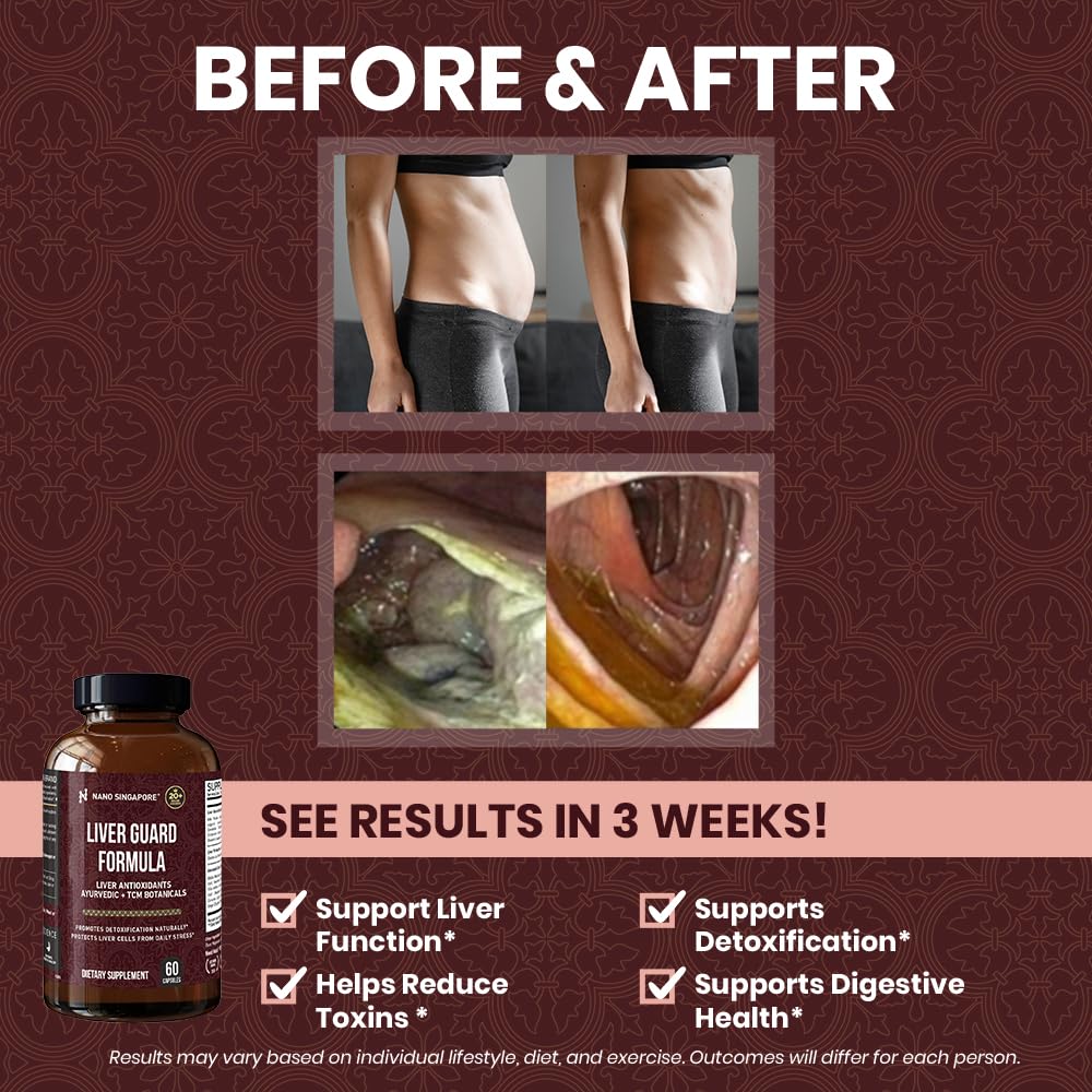 Nano Singapore Liver Guard Formula – Liver Health Support, Detox & Digestive Health | 60 Capsules