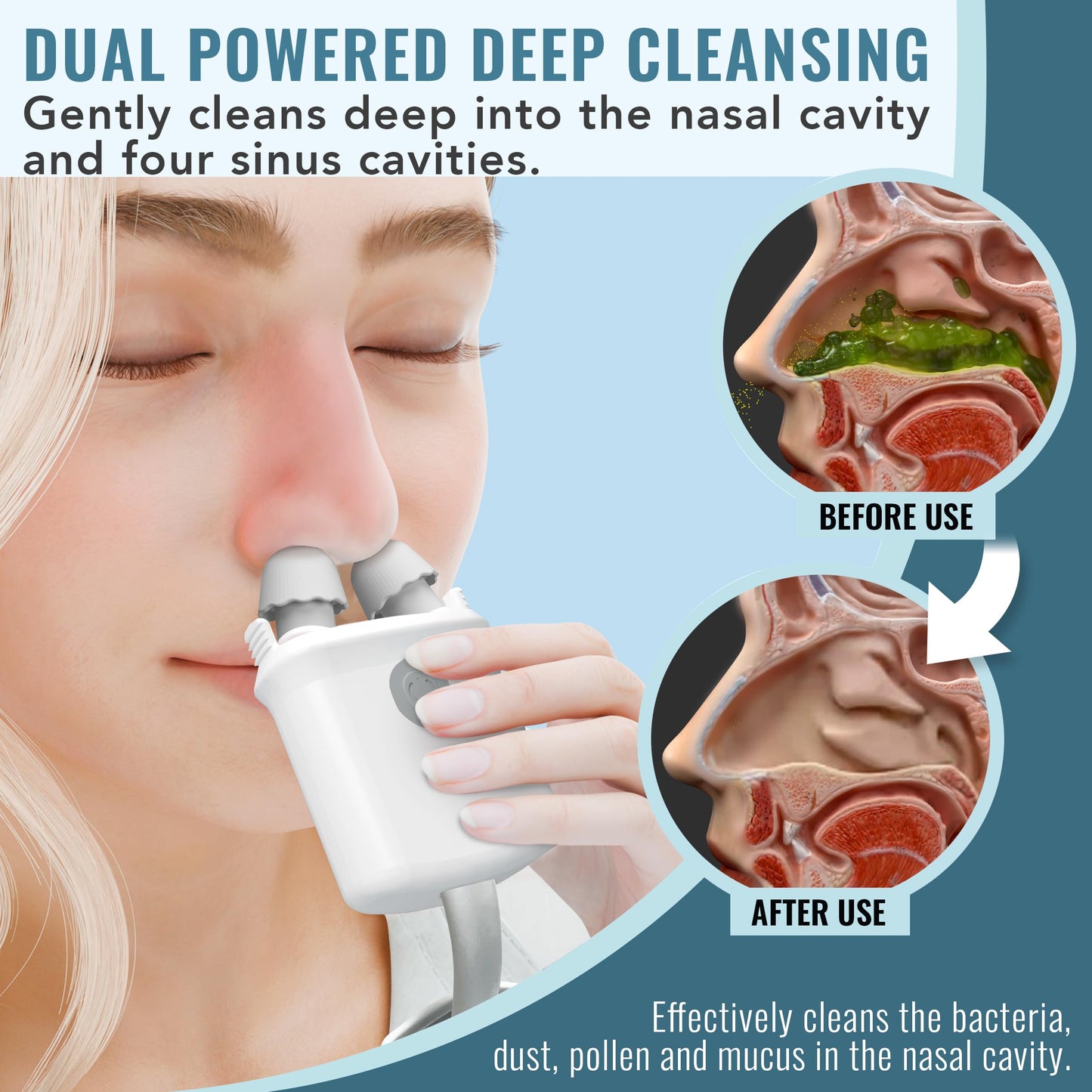 NASALFRESH MD Dual Powered Nasal Irrigation System – Rechargeable, 30 Saline Packets, 2 Nose Pillow Sets
