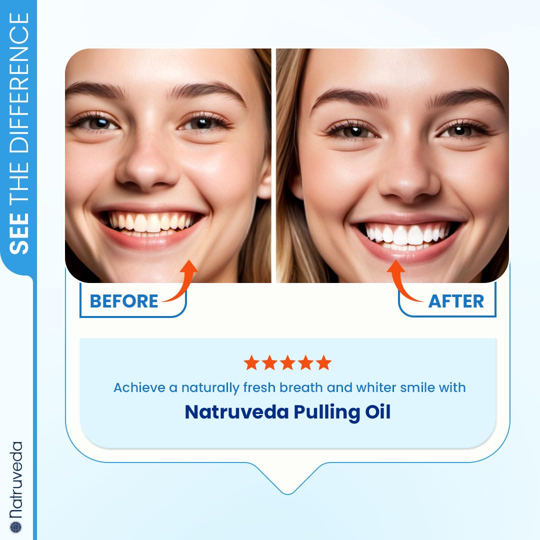 Natruveda Coconut Oil Pulling Mouthwash – Natural Whitening Ayurvedic Rinse | Fresh Mint Blend | Coconut Oil Pulling for Teeth & Gums | Whyte Oil Pulling | 10 oz