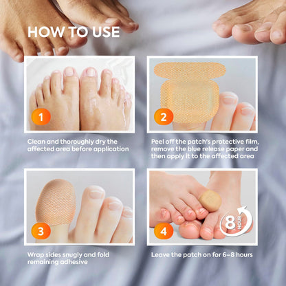 Natural Vine Fungal Nail Patches – Extra-Strength 1% Tolnaftate, Overnight Renewal (32 Patches x 2)