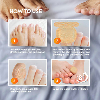 Natural Vine Toenail Fungus Patches — Extra Strength 1% Tolnaftate, 8-Hour Night Renewal | 32 Patches