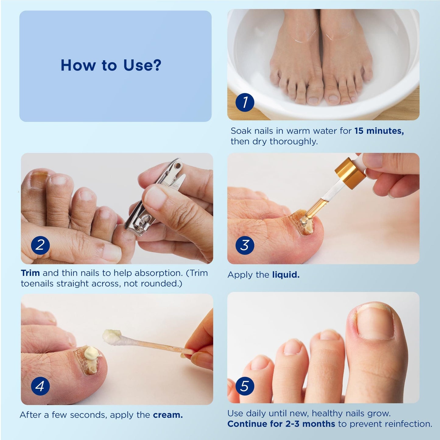 Natural Vine Toenail Fungus Treatment Kit | Patches, Liquid & Cream - Extra Strength